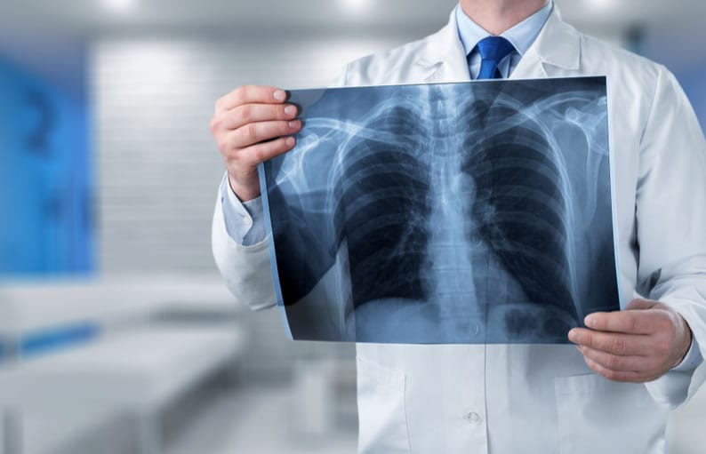 radiologia-e-radiografia